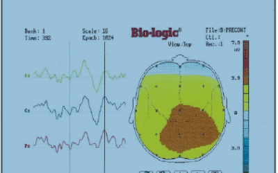 Effets comportementaux, électrophysiologiques et audiométriques chez les sujets TSA (1999)